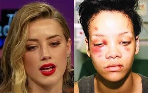 Rihanna’s ‘b Ten Up’ Pic Compared To Amber Heard’s By Johnny Depp Fans As They Say This Is