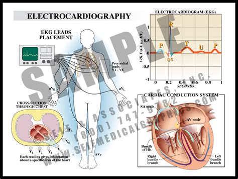 Electrocardiography Sanda Medical Graphics