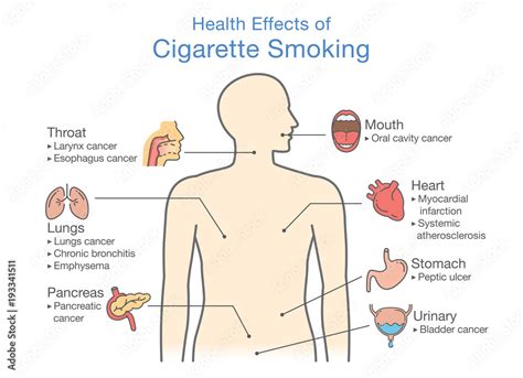 Diagram About Health Effect Of Cigarette Smoking Illustration About
