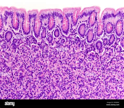 Gastric Mucosa Showing The Surface Mucous Epithelium The Gastric Pits