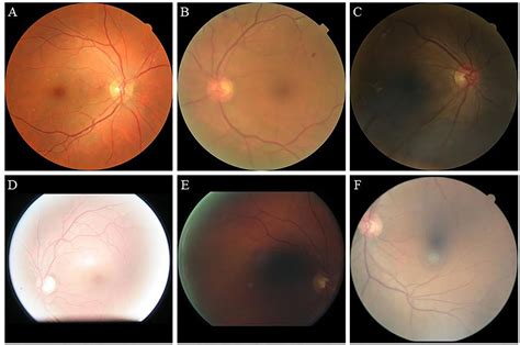 Frontiers Retinal Image Enhancement Using Cycle Constraint