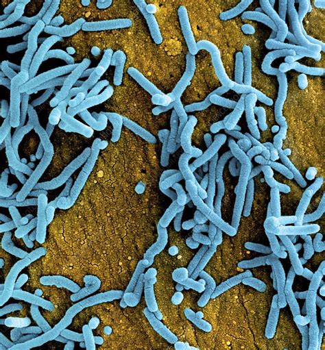 14 hours ago · the marburg virus belongs to the same family as ebola, and previously outbreaks have erupted elsewhere across africa in angola, congo, kenya, south africa and uganda. Marburg virus, SEM - Stock Image - C046/8192 - Science ...