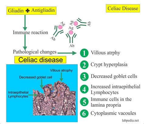 Gliadin Antibodies Iga Igg Endomysial Antibodies Celiac Disease And