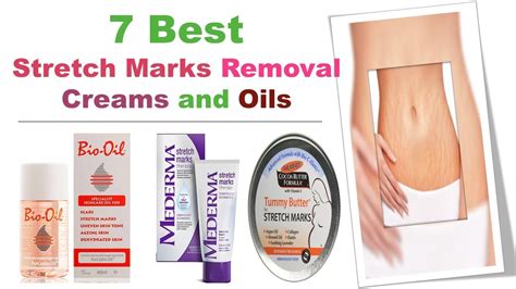 7 Best Stretch Marks Removal Creams And Oils YouTube