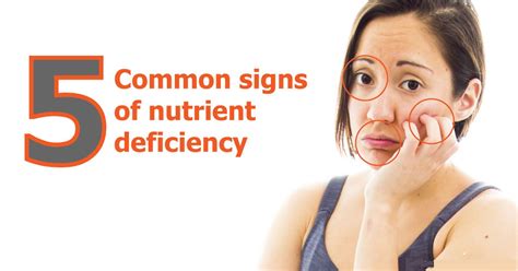 5 Signs Youre Nutrient Deficient Health And Fitness Solution