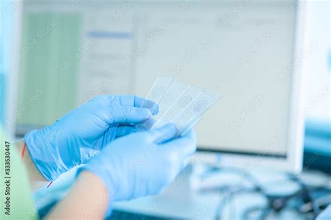 microscopic testing of patient biopsy samples medical hospital test lab hands in protective