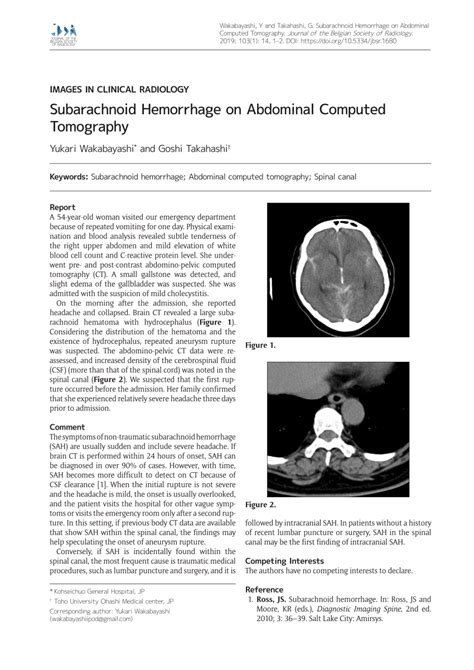 Pdf Subarachnoid Hemorrhage On Abdominal Computed Tomography