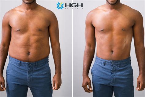 Real Life Hgh Before And After Results Hgh Vallarta Clinic