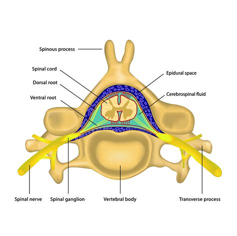 Epidural Infiltrations For Treating Back Pain Orthopaedie
