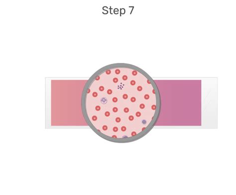 Differential Blood Test Process And Interactive Diagrams Getbodysmart