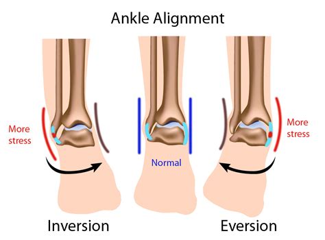 Lets Talk Injury Prevention Physiotherapy Clinic And Rehab Centre Markham