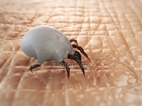 House Dust Mite On Human Skin — Computer Close Up Stock Photo