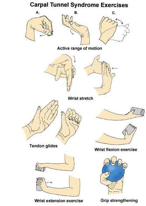 Carpal tunnel syndrome is a disease of the hand characterized by numbness, tingling, pain, and weakness. exercises for carpal tunnel syndrome | Carpal tunnel ...