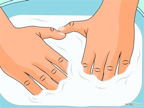 How To Treat Hand Eczema Dorothee Padraig South West Skin Health Care
