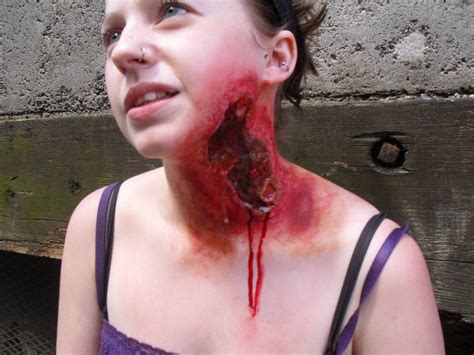 In some cases death can occur within 12 to 24 hours. Necrotizing fasciitis by FinnFX on DeviantArt