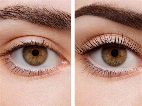 Lasik eye surgery may be a better vision solution than contact lenses. Lash Lifting Services | Tyler, TX | Mont-Ro Skin Care