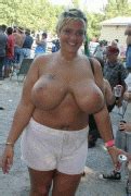 Forumophilia Porn Forum Bizarre Deformed Tits Nipples