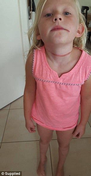 Adelaide Girl Nearly Killed After Hat Is Stuck In Slide Daily Mail Online