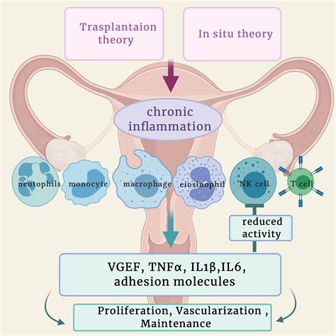 Learn the basics of endometriosis at discovery health. Cureus | Inflammation to Infertility: Panoramic View on ...