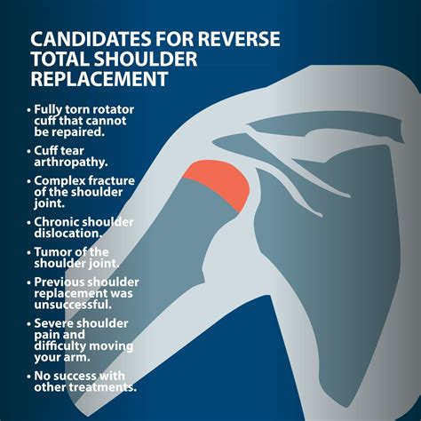 Reverse Total Shoulder Replacement Florida Orthopaedic Institute