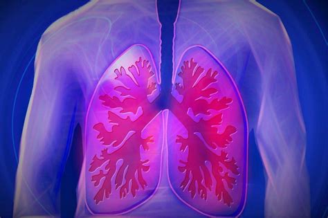 Collapsed Lung An Overview Of The Symptoms Diagnosis And Treatment