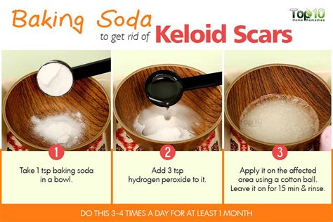 How To Get Rid Of Keloid Scars Top 10 Home Remedies