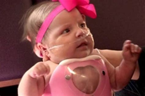 Video Baby Born With Heart Outside Body Leaves Hospital