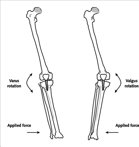 Direction Of Force Application And The Resulting Motion At The Knee In