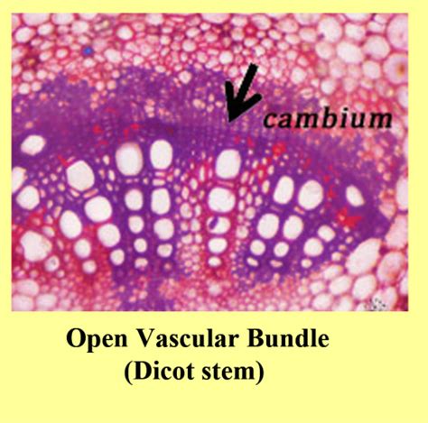 How Open Vascular Bundles Differ From Closed Vascular Bundles