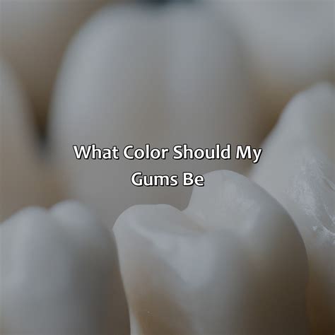 What Color Should My Gums Be