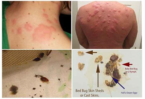 Bed Bug Treatment And Extermination Cost Guide How Much Hello Portable