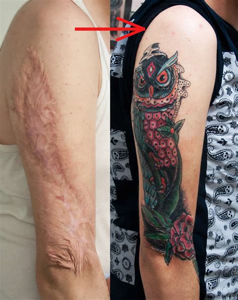 Tattoos over scars are something that comes to mind when trying to figure out a way to get rid scars you want to hide, but can you home » can you tattoo over scar tissue? 10 Most Awesome Birthmark & Scar Tattoos - Oddee