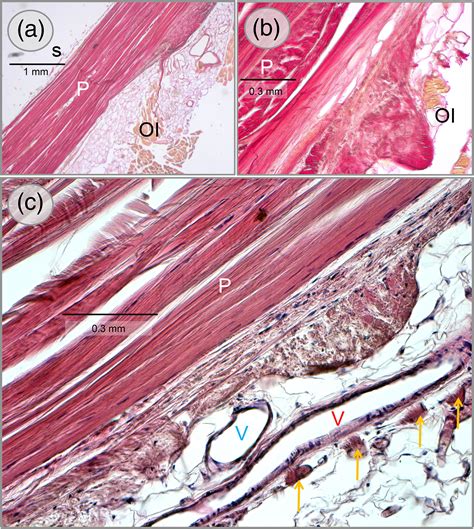 The Fascial Connections Of The Pectineal Ligament Steinke 2019