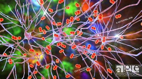 Bacteria Streptococcus Pneumoniae Infecting Neurons Brain Cells Stock