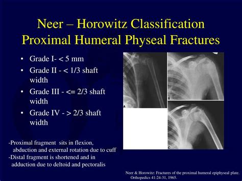 Ppt Fractures And Dislocations About The Shoulder In The Pediatric