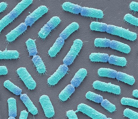 Bacillus Megaterium Bacteria 5 Photograph By Steve Gschmeissner