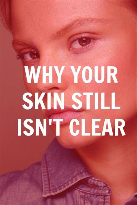 At upstate dermatology, we're dedicated to effectively treating diseases of the skin and providing the highest quality of patient care. Reasons Why Your Skin Still Isn't Clear Yet | Skin tips ...