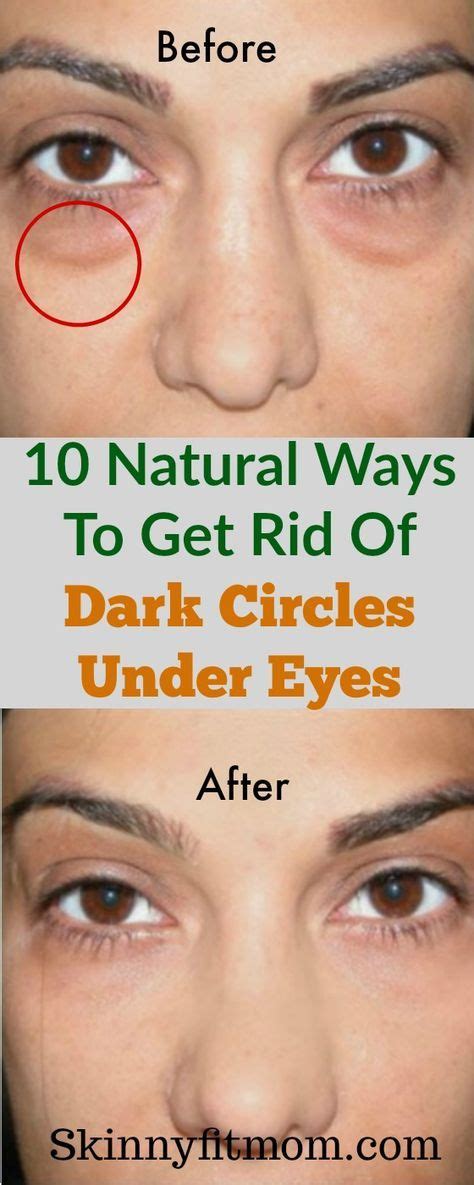 Dark Circles Can Spoil Make Up Made For Hours Use The Following