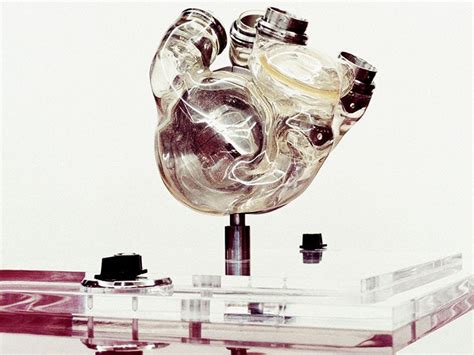 First Artificial Heart 1982