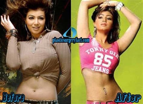 Ayesha Takia Plastic Surgery Before And After Photos Plastic Surgery