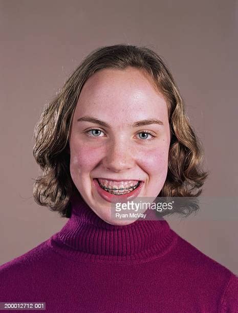 Teenage Girl 14 16 Wearing Braces Smiling Portrait Close Up Photos And