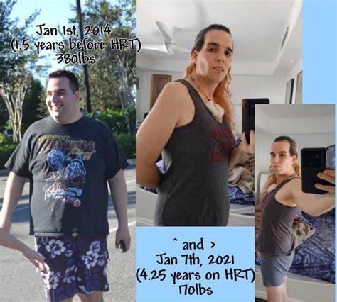 A Long 7 Year Journey From Jan 2014 380lbs172kg 15 Years Before