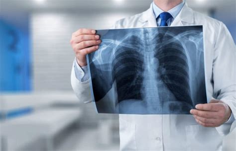 Radiologia E Radiografia Qual Diferen A E A Import Ncia Para Sociedade