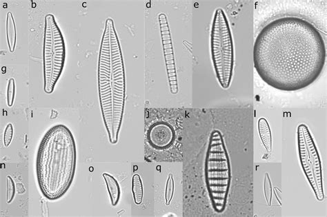 What Is A Diatom