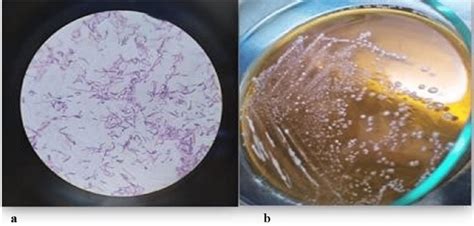 Morphological And Microscopic Properties Of Lactobacillus Bulgaricus