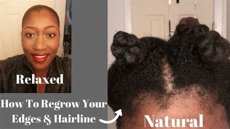 How To Easily Regrow Your Edges And Hairline 2018 Youtube