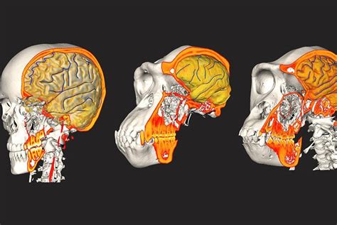 Human Brain Braincase Evolved Independently Researchers Say