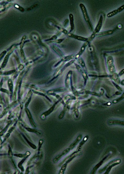 Free Picture Bacillus Anthracis Endospores Phase Contrast Microscopy