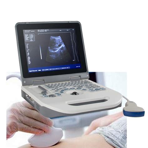 Best Portable Ultrasound Machine For Home Use 6 Best Review Drugsbank