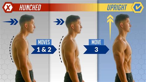 The Easiest Way To Fix Hunched Posture 3 Daily Moves